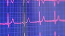 Schlaf herzgesundheit: Herzmonitor