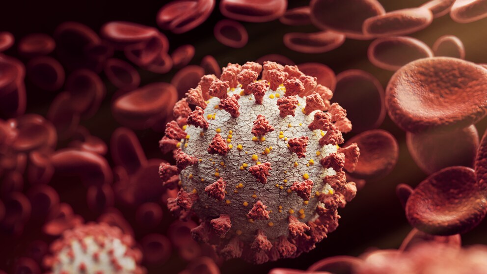 Coronavariante BA.2.75: Illustration des Coronvirus