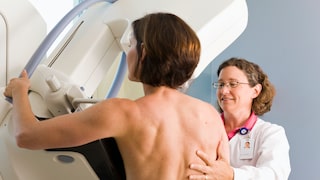brustkrebs vorsorge: Frau bei der Mammographie