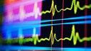herzinfarkt schlaganfall symptome frauen: Herz-Monitor