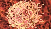 krebsfälle unter 50: Krebszelle