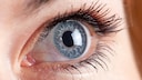 geplatzes Äderchen im Auge