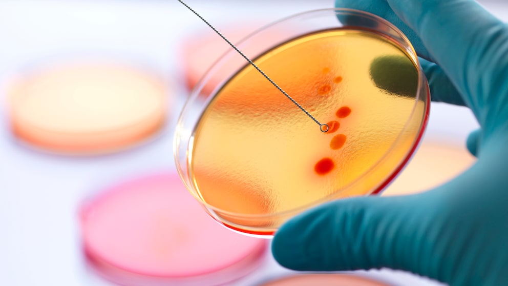 antibiotikaresistenz: Wissenschaftler bei einer Laboruntersuchung