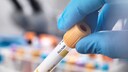 Ab dem 35. Lebensjahr kann man sich einmalig kostenlos beim Arzt auf Hepatitis B und C testen lassen