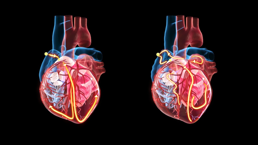 Illustration des Herzens und seiner elektrischen Impulse