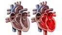 Broken Heart Syndrom Illustration