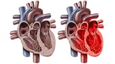 Broken Heart Syndrom Illustration