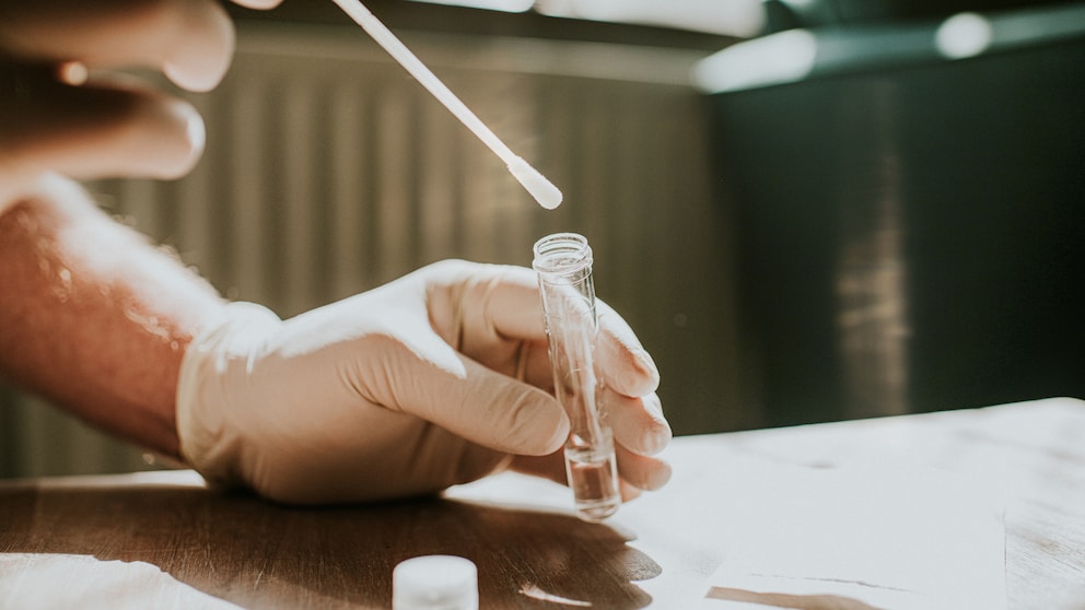 Forscher fanden heraus, dass sich im Stuhl Biomarker für Parkinson finden lassen