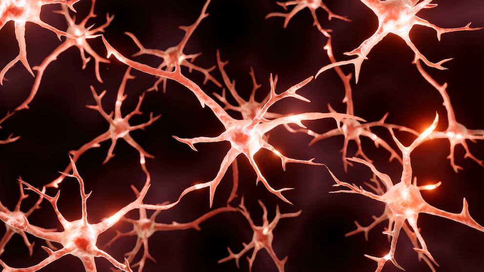Fettleber Gehirn: Neuronen im Gehirn
