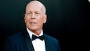 Bruce Willis hat frontotemporale Demenz