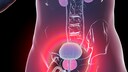 Die Prostata (im Bild rosa eingef&auml;rbt unterhalb der Blase) kann ein krankhaftes Wachstum entwickeln. Man spricht dann von Prostatakrebs