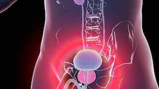 Die Prostata (im Bild rosa eingefärbt unterhalb der Blase) kann ein krankhaftes Wachstum entwickeln. Man spricht dann von Prostatakrebs