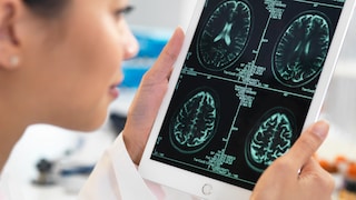endometriose schlaganfallrisiko: Ärztin schaut sich Gehirn-Scans an