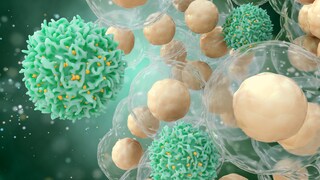semaglutid krebs: Illustation von T-Zellen (Killerzellen), die Krebszellen angreifen