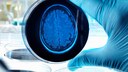 espresso alzheimer: Eine Person hält eine Schale mit einem Gehirn-Röntgenbild