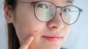 Was Pickel im Gesicht über die Gesundheit verraten
