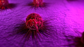 thymus krebs: Krebszelle