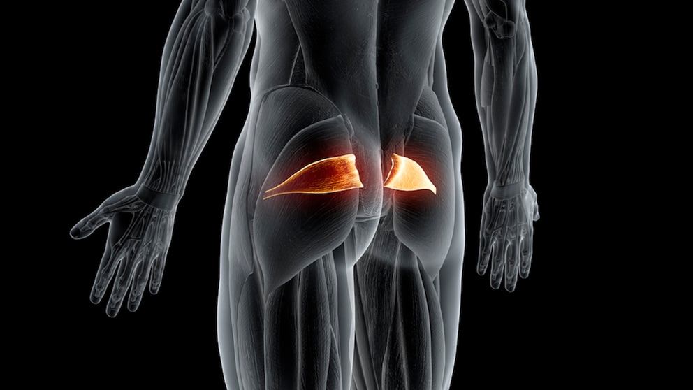 Piriformis-Syndrom – Symptome, Ursachen, Therapie