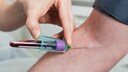 Schon früh Maßnahmen ergreifen und Alzheimer vorbeugen