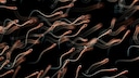 Spermaqualit&auml;t und Spermienzahl nehmen ab