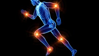 Illustration Läufer mit Schmerzen