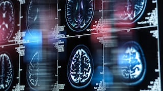 Aufnahmen aus der Alzheimer-Forschung