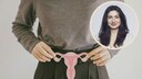 Endometriose