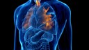 hochverarbeitete Lebensmittel sorgen für Gesundheitsprobleme