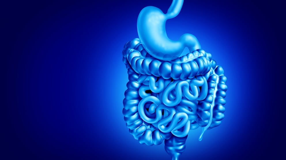 Körpertypen haben offenbar Einfluss auf das Risiko von Darmkrebs