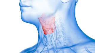 Inflamed larynx, illustration.