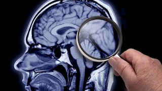 Alzheimer ketogene Ernährung