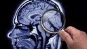 Alzheimer ketogene Ernährung
