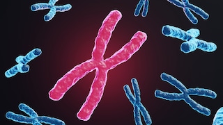 Chromosome haben einen Zusammenhang mit manchen Krankheiten, z. B. das seltene Angelman-Syndrom