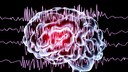 Ein EEG des Gehirns kann anzeigen, ob eine Neigung zu epileptischen Anfällen besteht.