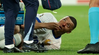 Kylian Mbappé mit gebrochener Nase, Fußball-EM 2024