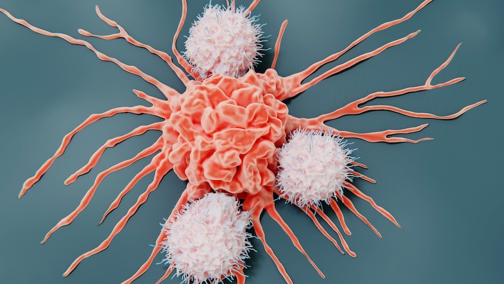Durch Intervallfasten gestärkte Killerzellen (NK-Zellen) im Kampf gegen Krebszellen