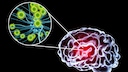 Enzephalitis (Gehirnentzündung)