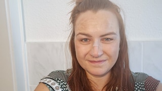 FITBOOK-Redaktionsleiterin Melanie Hoffmann mit Nasenklammer