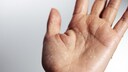 Schwitzende Hände / Hand