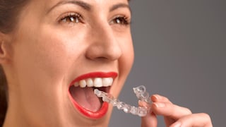 Aligner aus dem Internet