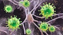 Herpes-Viren können im schlimmsten Fall sogar zu einer Gehirnentzündung (Enzephalitis) führen.