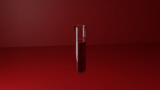 HIV-Test