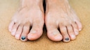 Runners Toe