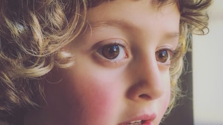 Viele Kinder erleiden eine Adenoviren-Infektion