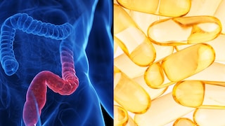 Wie Vitamin D helfen kann, Colitis-ulcerosa-Symptome zu lindern