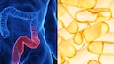 Wie Vitamin D helfen kann, Colitis-ulcerosa-Symptome zu lindern
