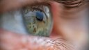 HDL-Cholesterin erhöht offenbar das Risiko für Grünen Star