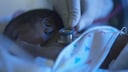 Baby mit Wilms Tumor