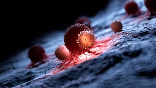 Forscher haben genauer untersucht, wie genau Diabetes mit einzelnen Krebsarten in Verbindung stehen könnte