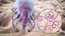 Lyme-Borreliose kann von Zecken übertragen werden